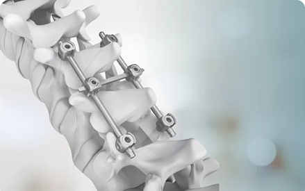 Performanța și utilizările materialelor din aliaj de titan, cum ar fi tijele medicale de titan.